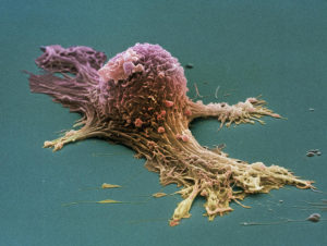 cancer-cell